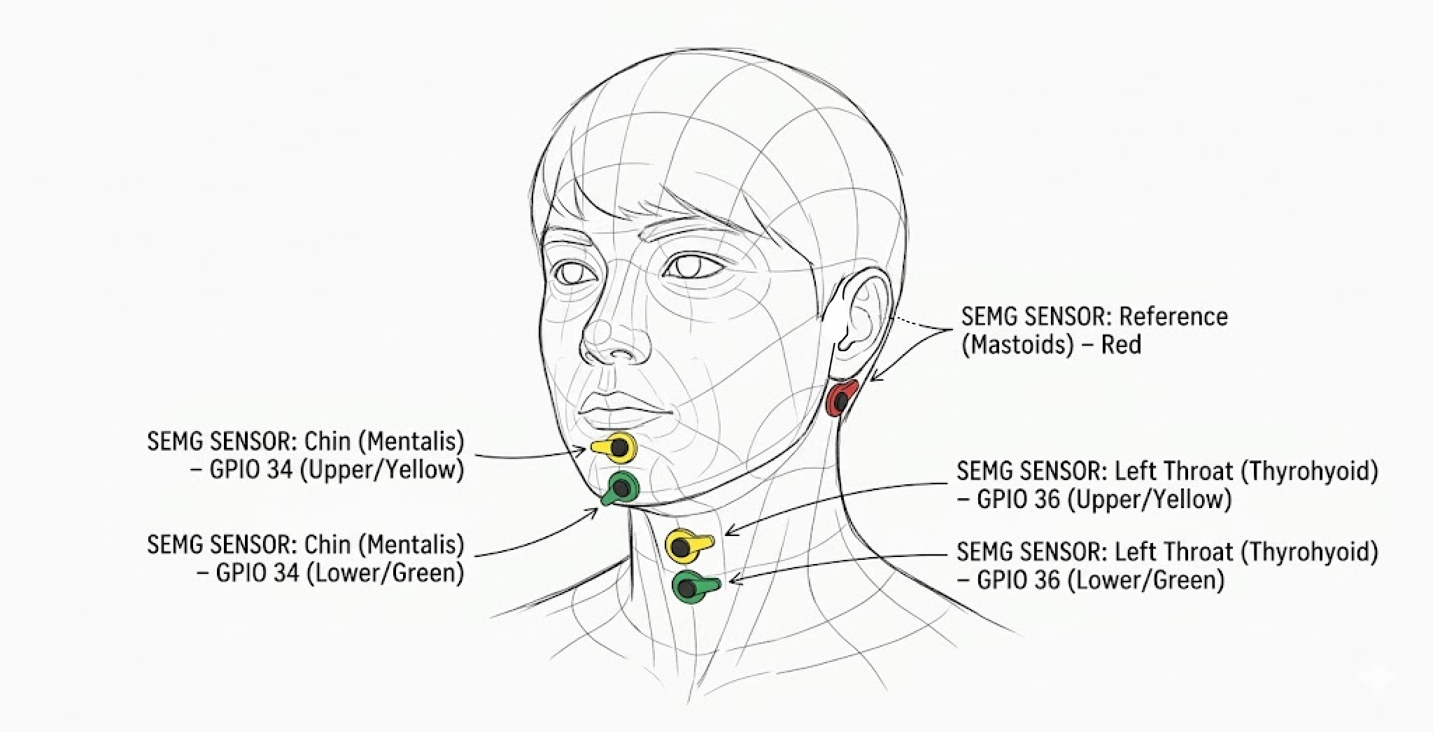sEMG electrode placement diagram